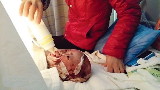 家人在医院陪护小雨丹。图片来源：南国早报