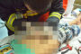 贵港10岁男孩身体敏感部位被钢圈套肿(图)
